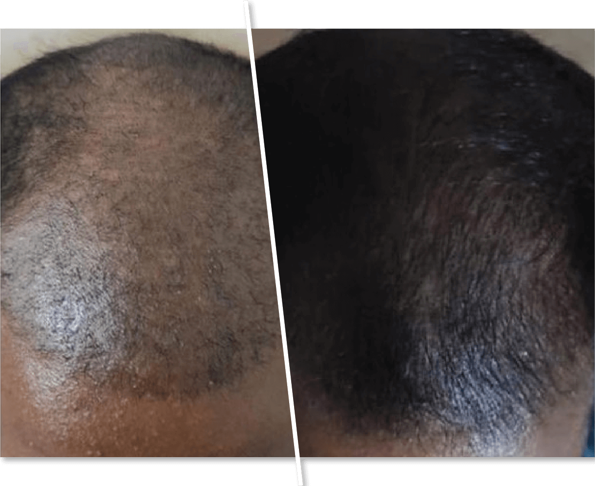 Before and After Hair Treatment